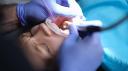 Dental Sealants Market Growth Slows Amid Awareness, Access, Regulatory, and Cost-Related Barriers Worldwide
