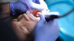 Dental Sealants Market Growth Slows Amid Awareness, Access, Regulatory, and Cost-Related Barriers Worldwide