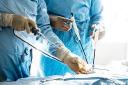 Laparoscopic Devices Market Shifts Reflect Growing Role of AI and Smart Imaging Tools