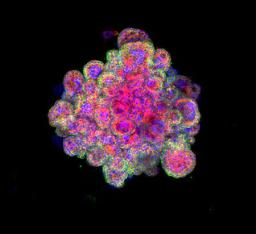 Organoids Market Emerging Trends Driving Advancements in Biomedical Research and Personalized Medicine
