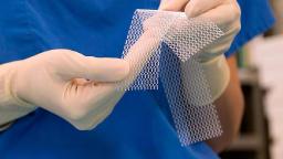 Surgical Mesh Market Growth Driven by Technological Advancements and Increasing Global Surgical Procedures