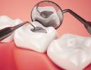 Tooth Filling Materials Market Winning Strategies Enhancing Innovation, Competitiveness, and Global Growth Opportunities