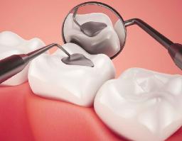 Tooth Filling Materials Market Winning Strategies Enhancing Innovation, Competitiveness, and Global Growth Opportunities