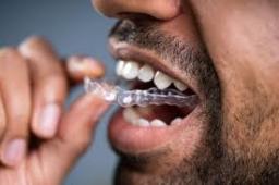 Orthodontic Retainers Market Sees Growth Due to Rising Orthodontic Cases Among Adolescents