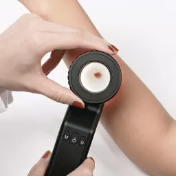 Peering Beneath the Surface: An In-Depth Look at the Dermatoscopes Market