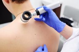 The Future of Dermatoscopy: Market Dynamics and Projections