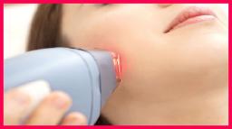 Technological Advancements Driving the Aesthetic Lasers Market