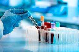 Clinical Laboratory Tests Market: Trends, Segmentation, and Competitive Landscape