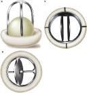 Prosthetic Heart Valves Market Trends: What Investors and Stakeholders Should Watch