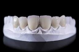 Dental Ceramic Market analysis of raw material availability and sustainability challenges