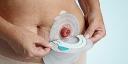 Technological Innovations to Transform the Landscape of the Ostomy Devices Market