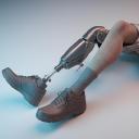 Artificial Limbs Market Faces Key Barriers Amid Growing Global Demand